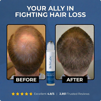 Revolutionary Roll-on Hair Growth Serum